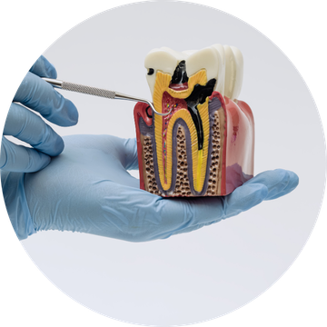 endodoncia