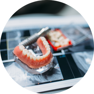 Prótesis dentales