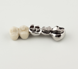 prótesis dental