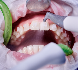 limpieza dental