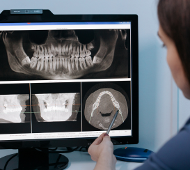 radiografía dental